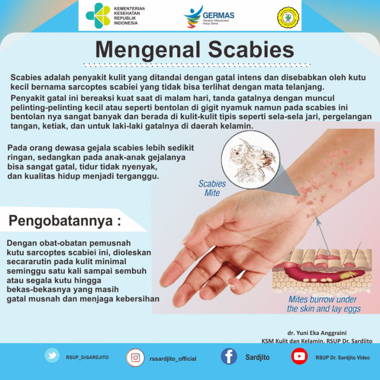 Rsup Dr Sardjito Mengenal Scabies